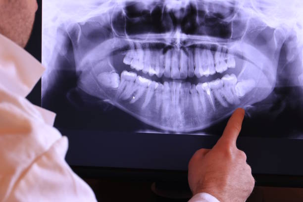 Best Emergency Treatment for Dental Infections or Abscesses in West Liberty, KY